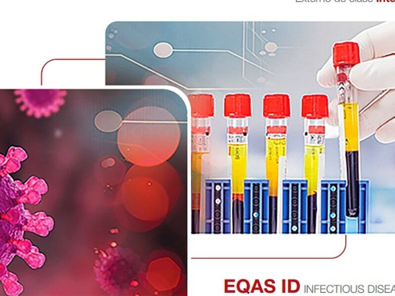 EQAS para enfermedades infecciosas Quito